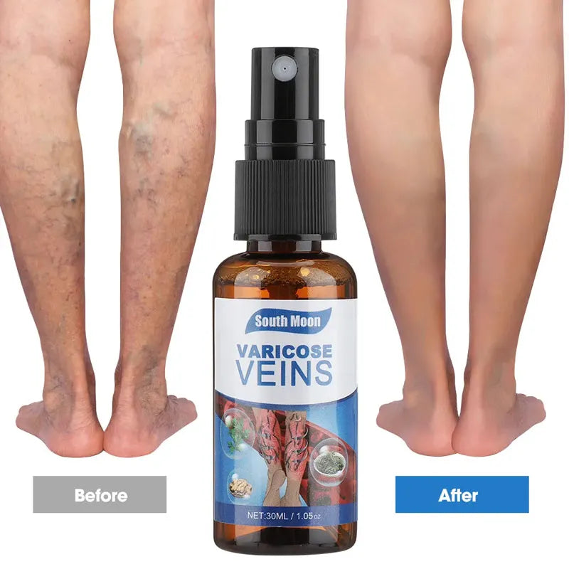 Miracle Veins Spray