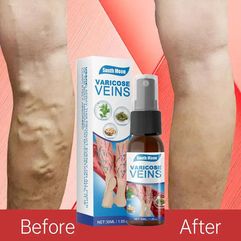 Miracle Veins Spray