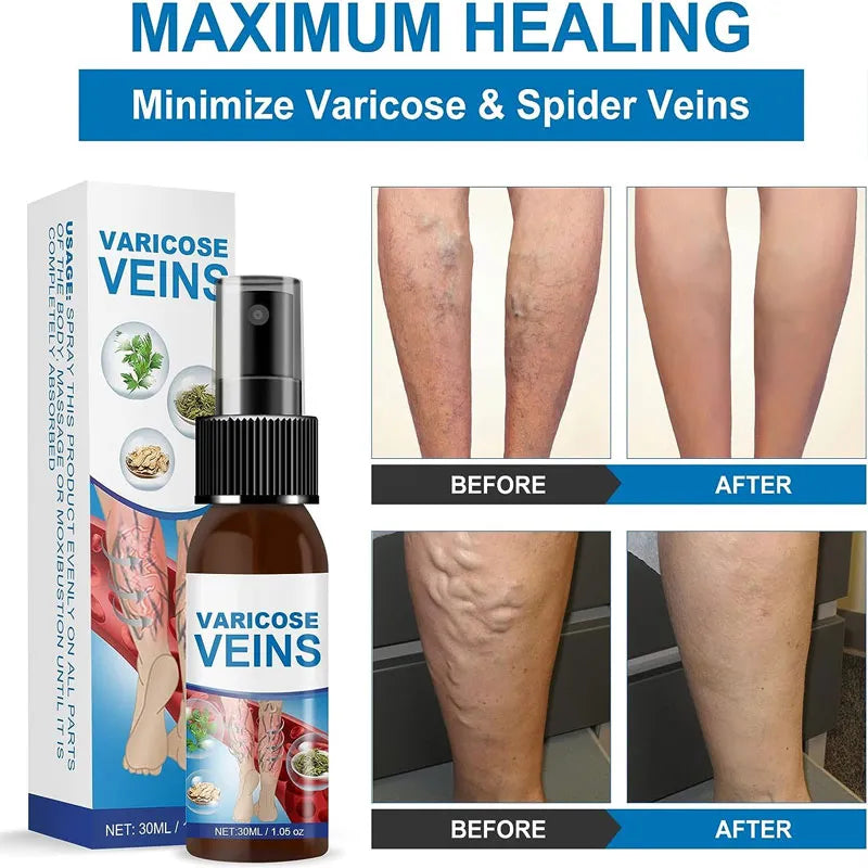 Miracle Veins Spray